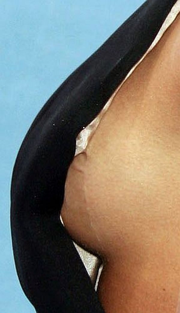 Jessica Alba Nip Slip? Not This Time! Thanks To Tuf-Skin.