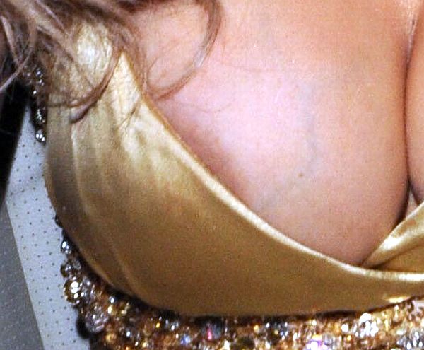 UK Model Melinda Messenger Areola Slip