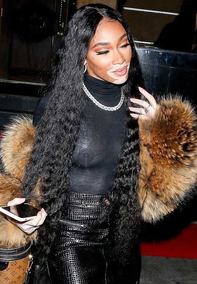 winnie harlow, titties, boobies, naked, nude,